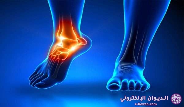 ANKLE PAIN