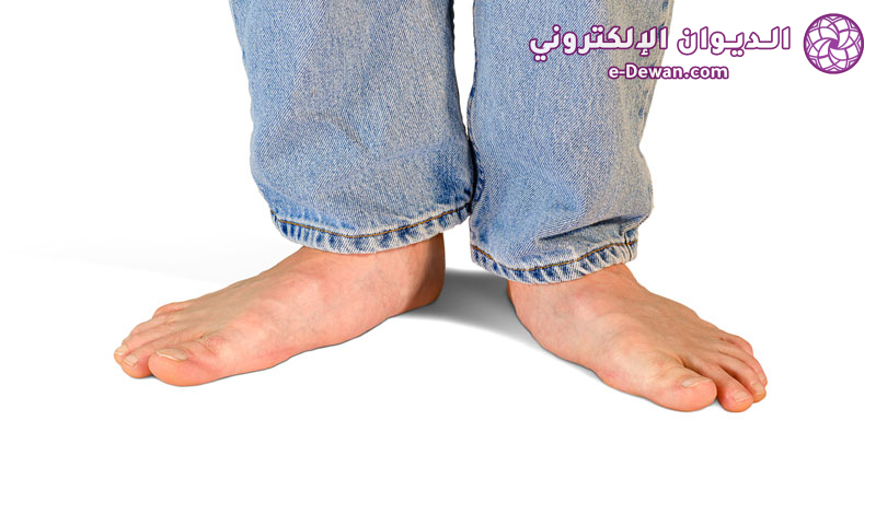 Flat Feet Symptoms and Treatment