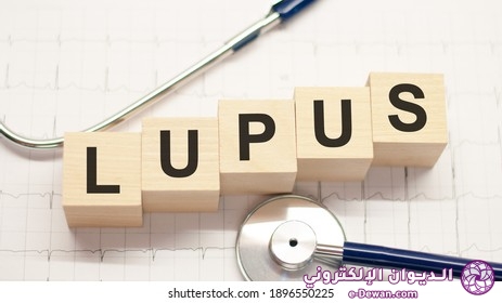 Lupus word written on wooden 260nw 1896550225